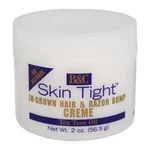Skin Tight Grown Hair Razor Bump Creme Regular 2 Oz Pack Of New. Price: $29.65.